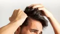 خوراکی‌هایی که به موهای شما جان دوباره می‌بخشند