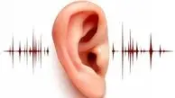تشخیص وزوز گوش از روی حرکات صورت
