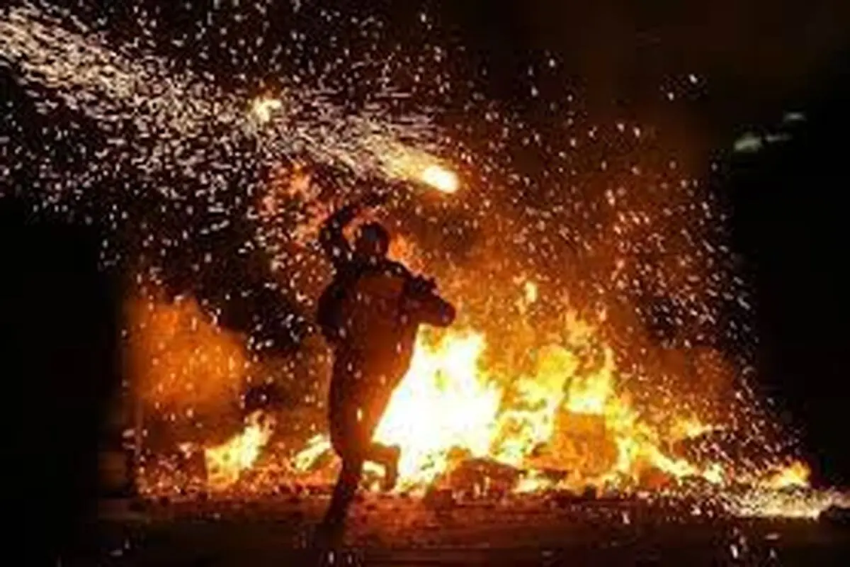 تخلیه چشمِ یک مصدوم حادثه چهارشنبه سوری

