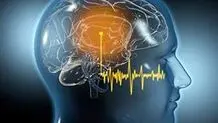 سکته گوش چیست و چگونه درمان میشود؟
