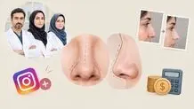جراح بینی فانتزی شیراز: معرفی لیست منتخب به همراه نمونه کار و قیمت
