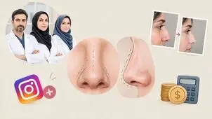 جراح بینی فانتزی شیراز: معرفی لیست منتخب به همراه نمونه کار و قیمت