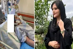 «مهسا امینی» در گذشته چندین بار به متخصص مغز و اعصاب مراجعه کرد