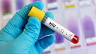 ۸۱ درصد مبتلایان به HIV مرد هستند