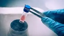 مجلس: فریز تخمک برای دختران مجرد بالای ۳۰ سال مشمول بیمه پایه می‌شود

