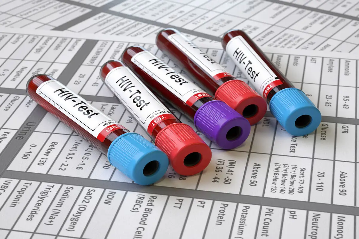 واکسن موثری علیه ایدز در جهان نداریم/ دسترسی رایگان بیماران ایرانی به داروهای HIV