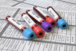 واکسن موثری علیه ایدز در جهان نداریم/ دسترسی رایگان بیماران ایرانی به داروهای HIV